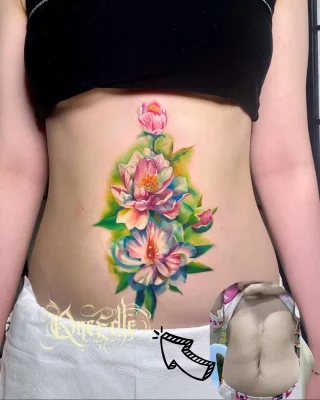 Stomach-scar-cover-color-tattoo-Qneedle-Studio-HCM