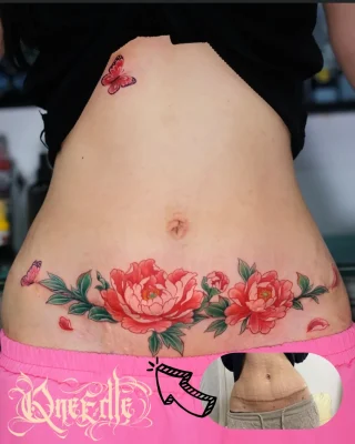 tummy-scar-cover-flowers-tattoo-Qneedle-Studio-HCM (2)