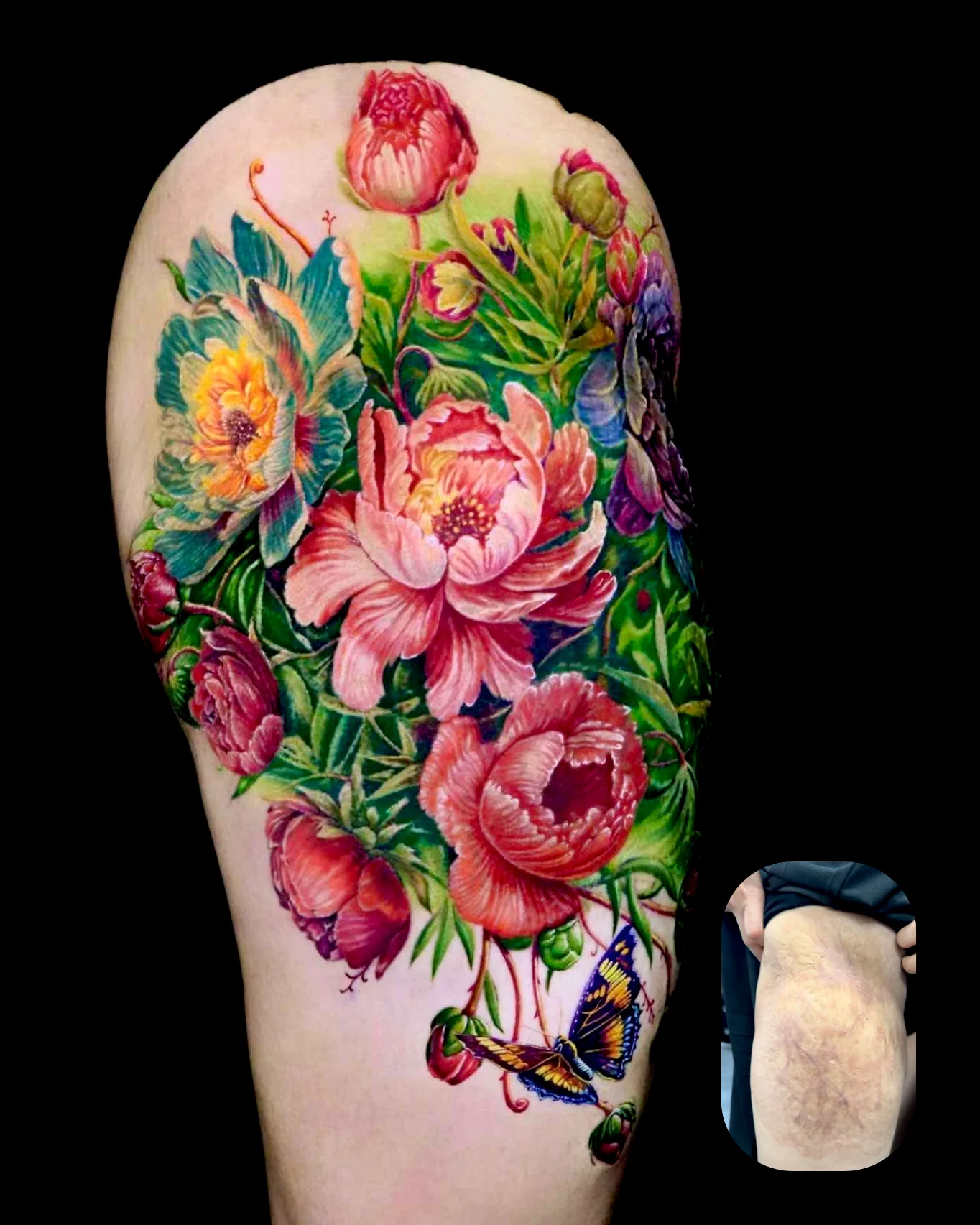 Scar cover tattoo with floral color design at Qneedle Tattoo Studio